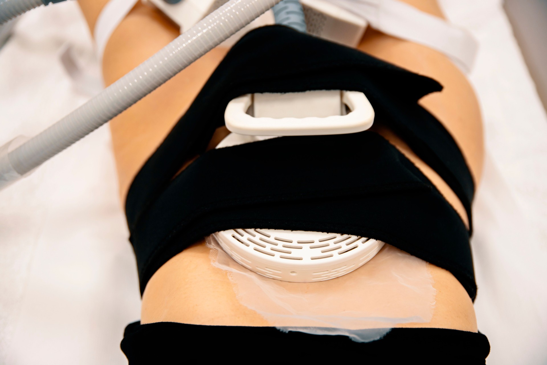 Non-invasive abdominal muscle stimulation therapy with advanced technology